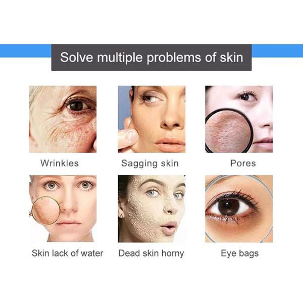 8 In 1 Hydra Dermabrasion Facial Aqua Peeling Machine Hydradermabrasion Microdermabrasion