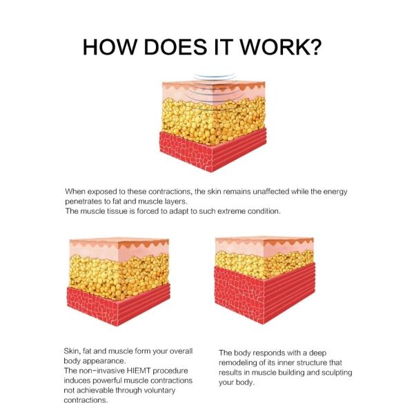 Machine électromagnétique magnétique de chargement initial du laser 220v de grosse perte