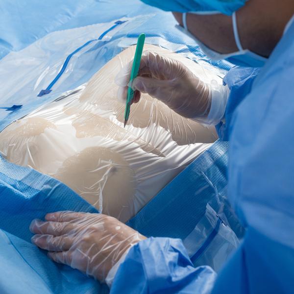 Хирургический устранимый Laparotomy подбрюшный задрапировывает класс набора пакета II