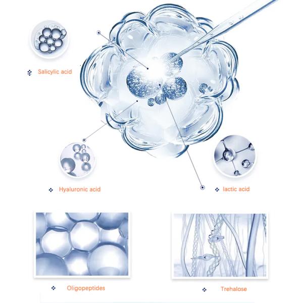 100ML Acne Exfoliating Toner With 2% Salicylic Acid Hydrating Facial Toner