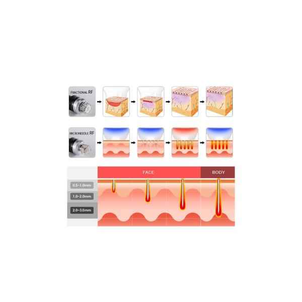 оборудование красоты стороны кожа RF protable иглы Mrico радиочастоты частичная затягивая машину Microneedle частичную Rf