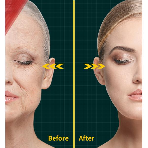 3in 1 IPL Laser Hair Removal Machine for Skin Rejuvenation on 15.4 Inch Touch Screen