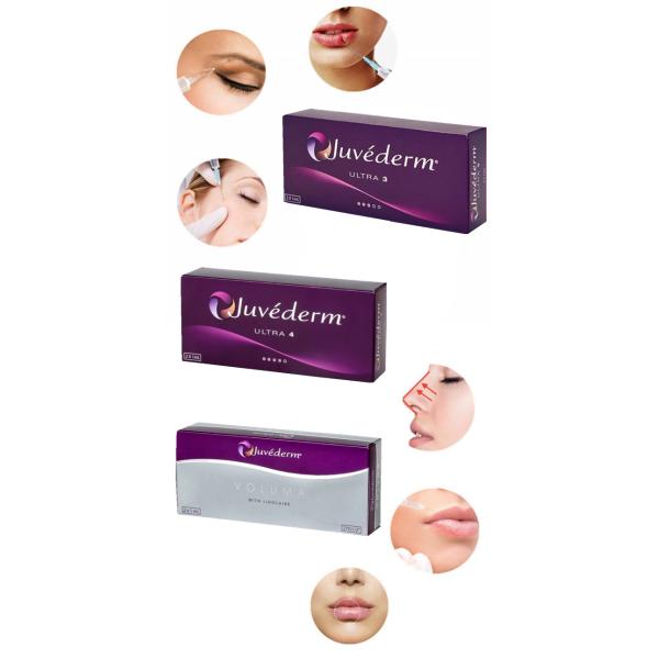Jawline Filling Lip Juvederm Dermal Filler HA Инъекционные наполнители для лица