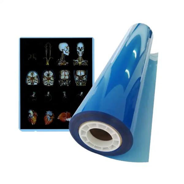 Advanced Blue Medical X Ray Film For Clear And Accurate Imaging