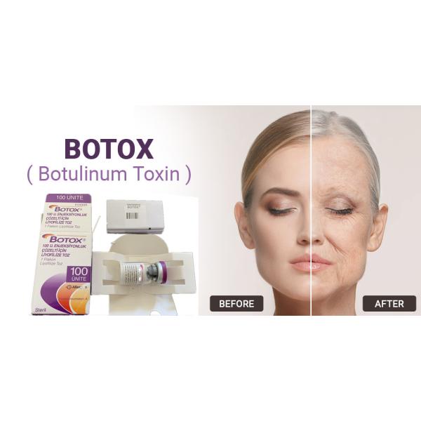 тип токсина 100Units Allergan Botulinum впрыска для лицевого удаления морщинки