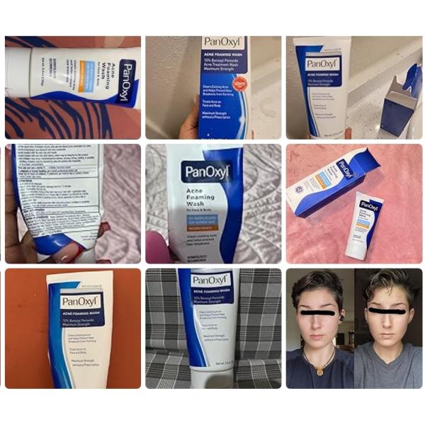 Antimicrobiano Peróxido de benzoilo Acné espumante Limpieza facial sin olor