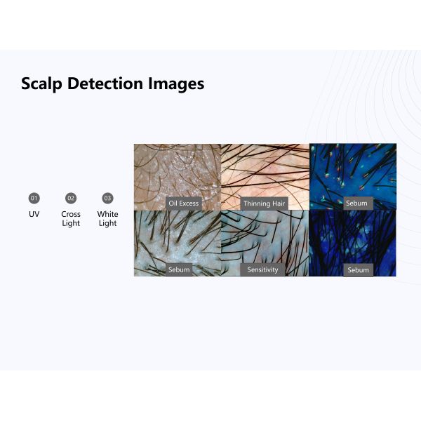 2in1 36 Million Pixel Skin And  Scalp Analyzer 3D AI Detection Skin Analyzer