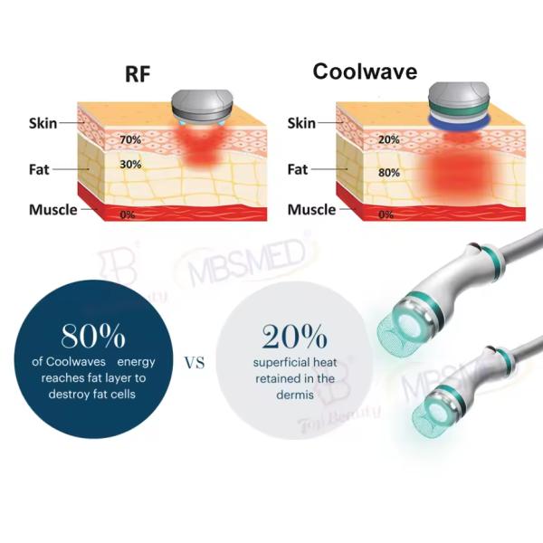 Coolwaves Cryotherapy Cool Radio Frequency Ems Muscle Stimulation Body Contouring Machine