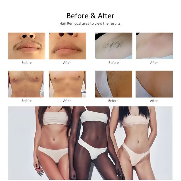 Full Body Female Hair Removal Machine 755nm 808nm 1064nm For Clinics / Beauty Salons