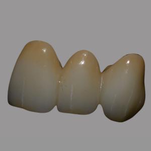 Dental Lab Zirconia Price | Natural Full Contour Zirconia Bridge Single Unit /