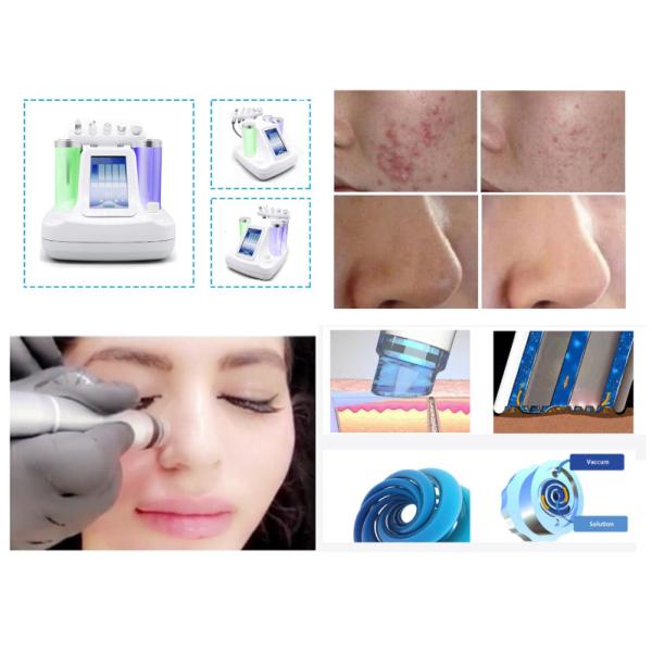 33*37*40cm Water Oxygen Jet Peel Machine Hydra Diamond Dermabrasion Beauty Machine