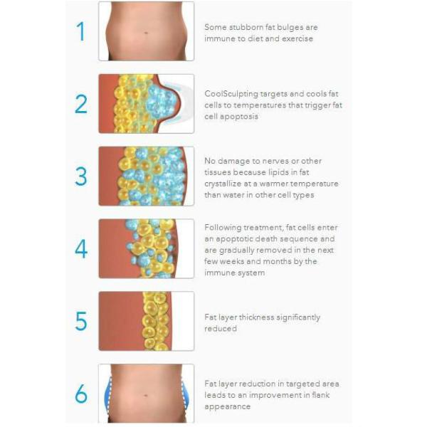 Best price Vacuum Cavitation+RF+Cryolipolysis 3 in 1 slimming machine for sale