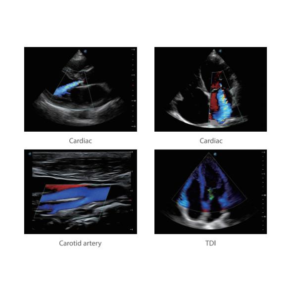 Cardiovascular Sonoscape P50 Ultrasonido Doppler Ultrasound Machine