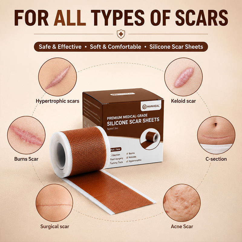 Brown Silicone Gel Scar Tape Rolls in 1.5 m and 5 m Lengths