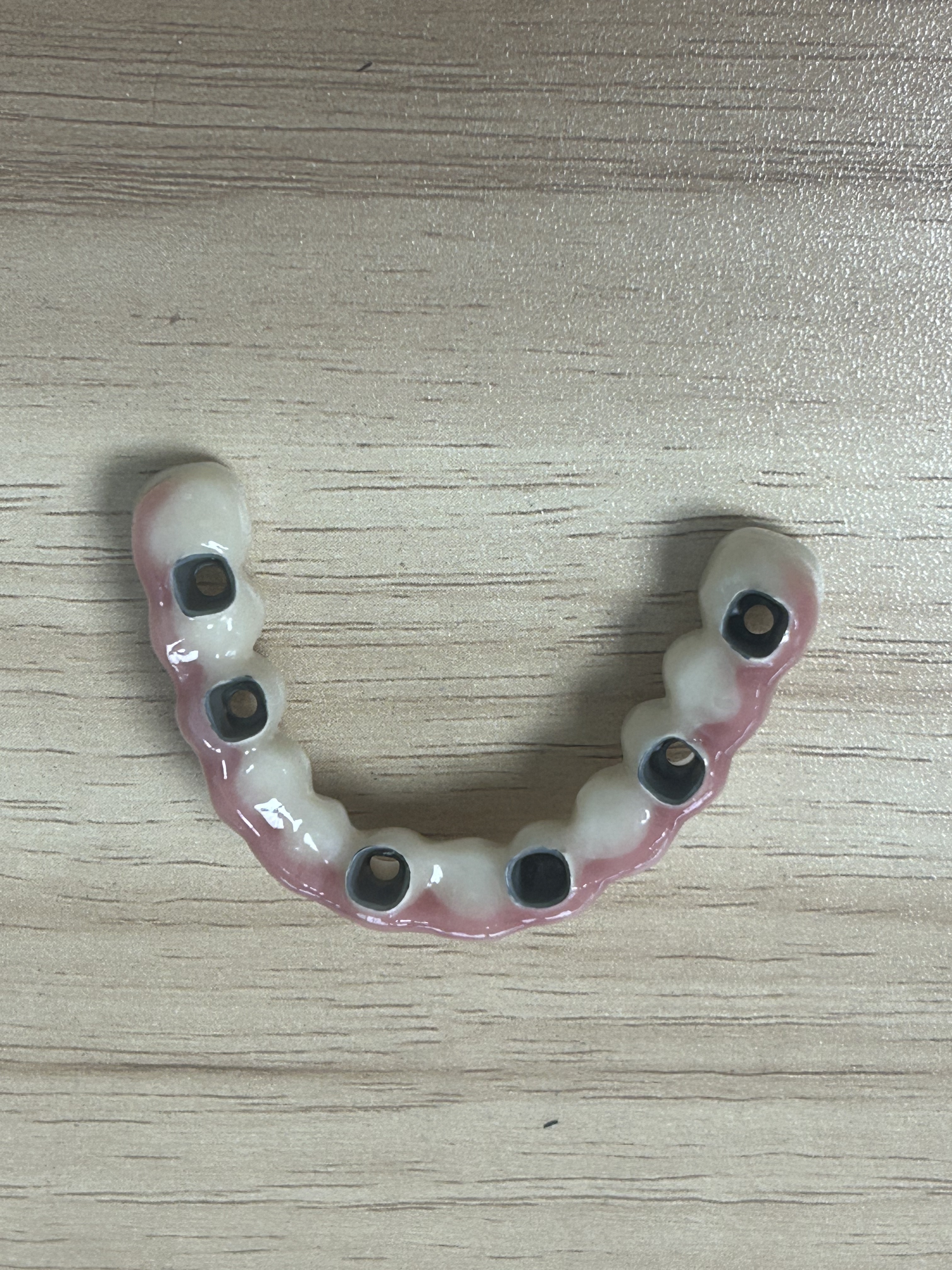 High-Strength Dental Zirconia Implant Crown with Natural Translucency & Tooth-Like Appearance via Digital CAD/CAM