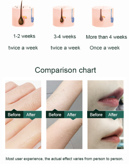 Sapphire Laser SHR Hair Removal Machine 640nm 480nm Permanent