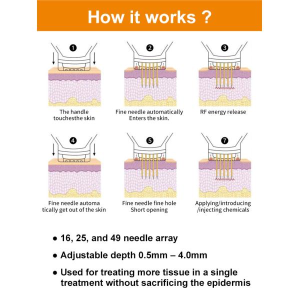 Non Surgical Skin Rejuvenation RF Microneedle Machine Radio Frequency 1-50W