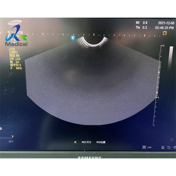 Samsung EVN4-9 Ultrasound Probe Repair Imaging With Dark Shadows