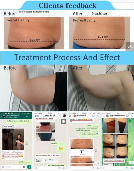 Fat Freeze slimm best seller  5 heads cryolipolysis slimming lipolaser fat frezzing machine Cryo Handles can work at sam