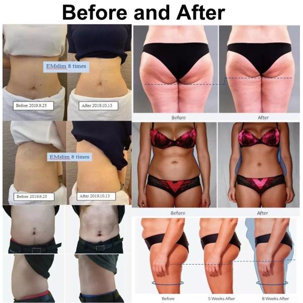 300us Slim Beauty Machine EM Sculpting 4 In 1 Cavitation Machine Muscle Stimulator