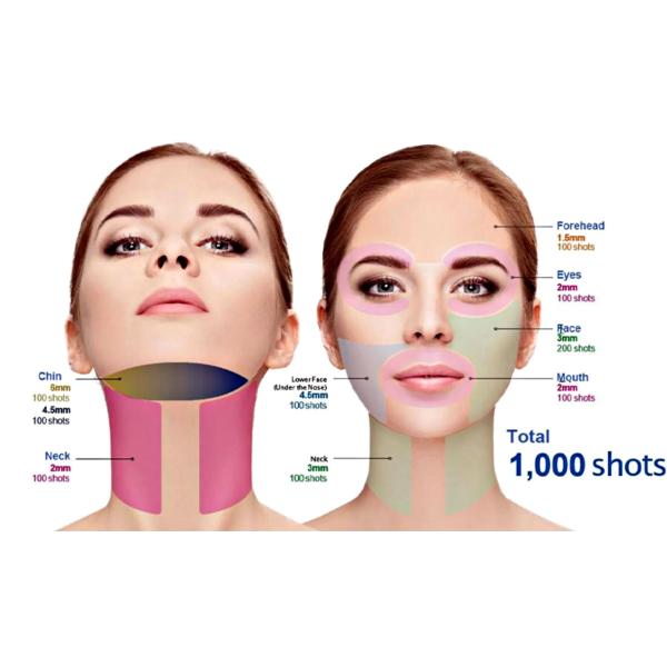 Vertical Hifu High Intensity Ultrasound Focused Korea Hifu Therapeutic Ultrasound Wrinkle Removal Face Lifting Machine