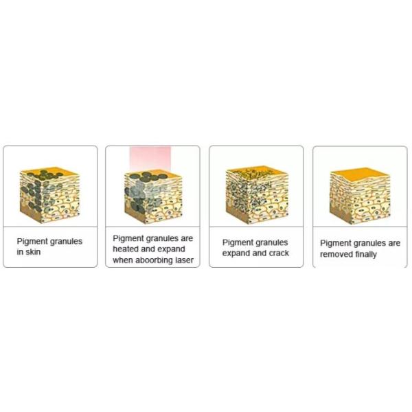 Multifunctional Tattoo Laser Removal Equipment With 1064 nm 532 nm Black Ball Tip