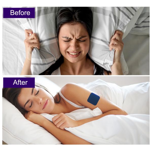 Topical Transdermal Sleep Vitamin Patch Foam Material Easy Absorption Reduce Stress