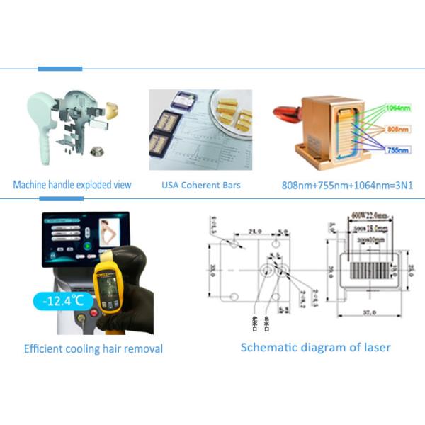 машина лазера сопрано Альма машины удаления волос лазера диода 1600watt 808nm