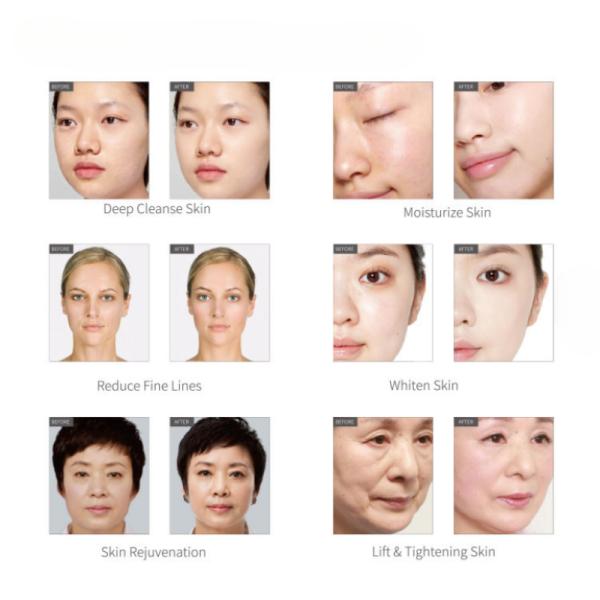 Professional Aqua Peel Machine Deep Cleansing Hydro Dermabrasion Skin Rejuvenation Device for Beauty Salon