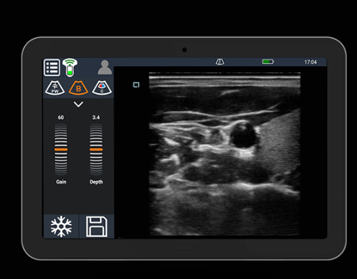 Portable Color Doppler Machine Handheld Ultrasound Scanner With Frequency 2~11MHz