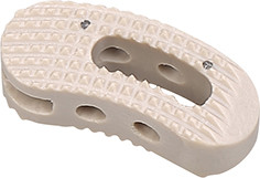 5 el plátano de la jaula II de la ojeada del grado TLIF formó la fusión espinal de la jaula