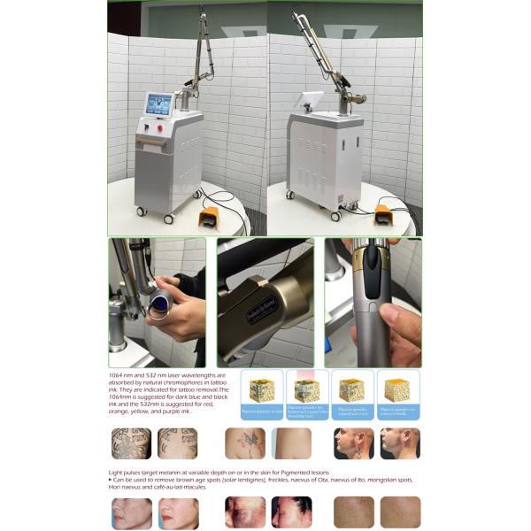 Good price nd yag q switch long pulse laser pigments tattoo and hair removal machine