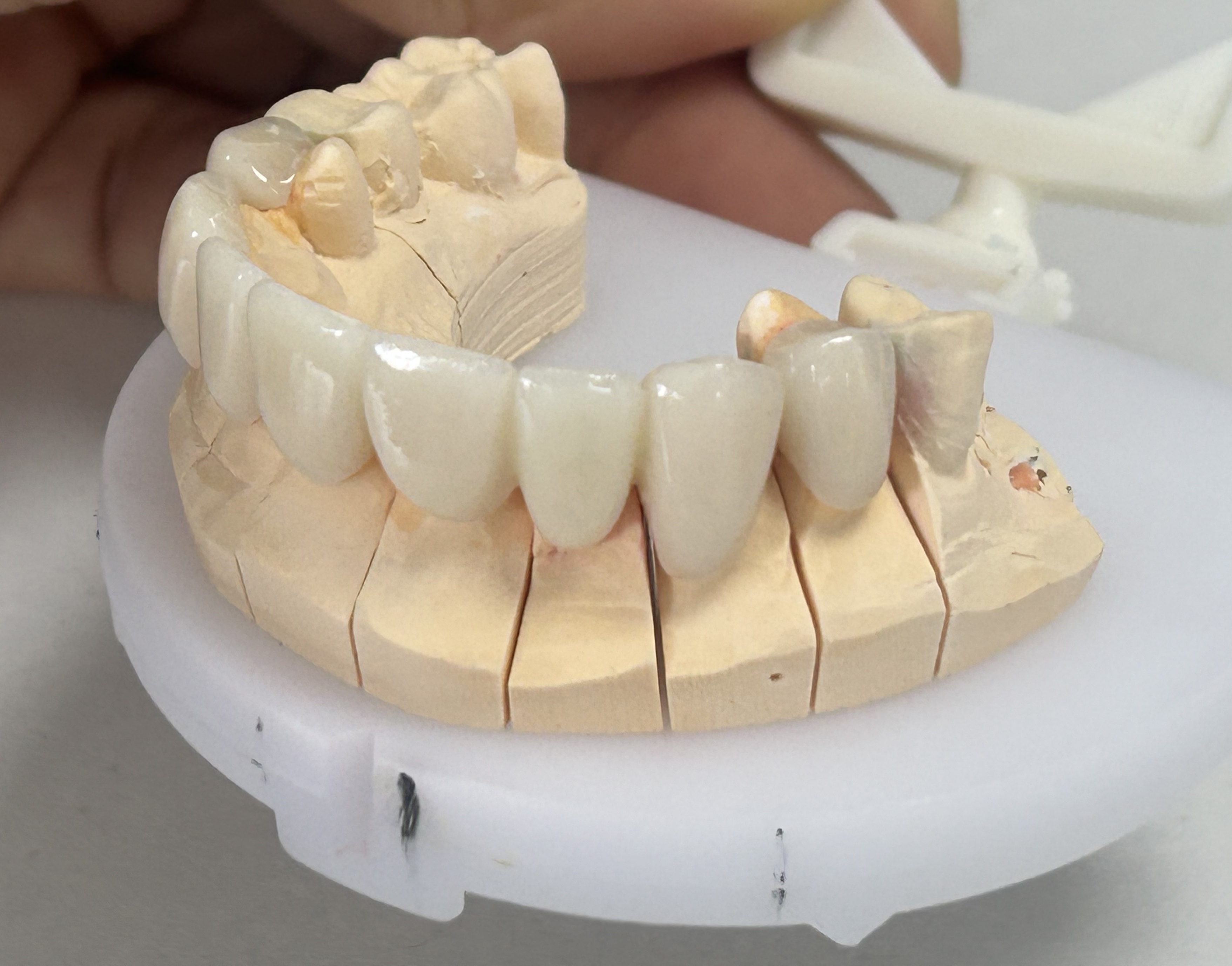 High Strength Full Zirconia Teeth with Natural Aesthetic from ShenZhen Dental Lab
