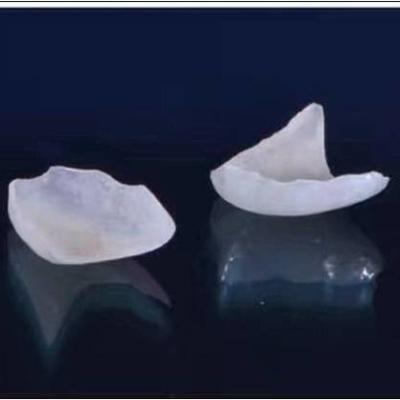 Natural Looking All Porcelain Veneers EMAX Dental Crown