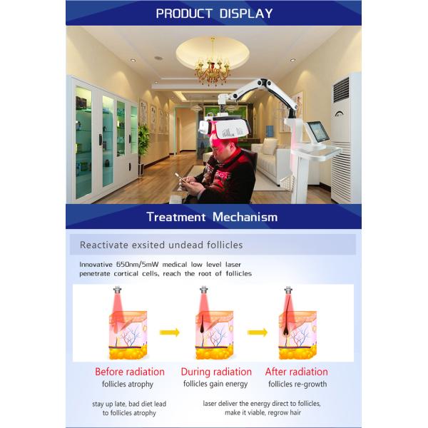 Обработка плешивости алопесии машины 650nm роста волос лазера диода LLLT