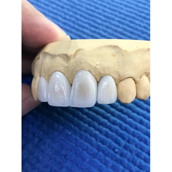 6 система цифров CADCAM пробела Zirconia слоя разнослоистая зубоврачебная филируя