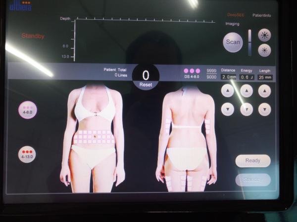 new technology skin tightening machine for face lift skin rejuvenation hifu machine