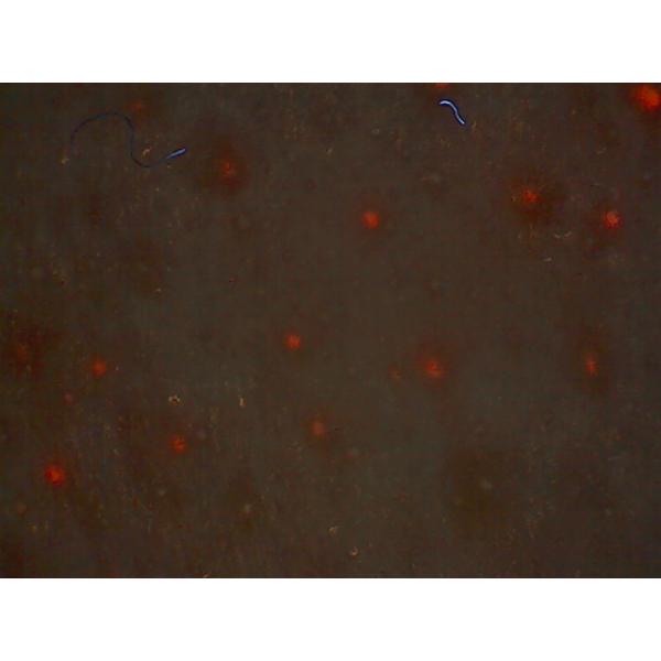 Многофункциональный наблюдаемый анализатор объема кожи