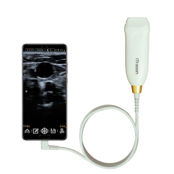 64 Channel 20mm Depth Handheld Ultrasound Scanner For Peripheral Vascular Assessment and Ultrasound-Guided Vascular Access
