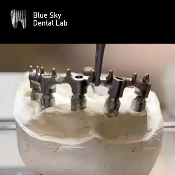 Implants dentaires Blue Sky Bar de titane argenté Pour les implants dentaires