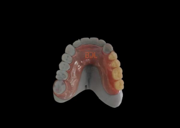No Metal Showing Hypoallergenic Flexible Partial Denture with 3-Day Turnaround for Comfortable Dental Restoration