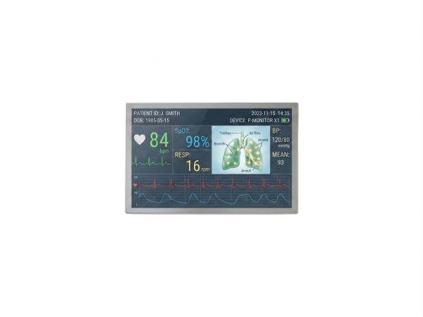 12.1 Inch IPS 1280×800 1000nits Medical TFT LCD Touch Display Module