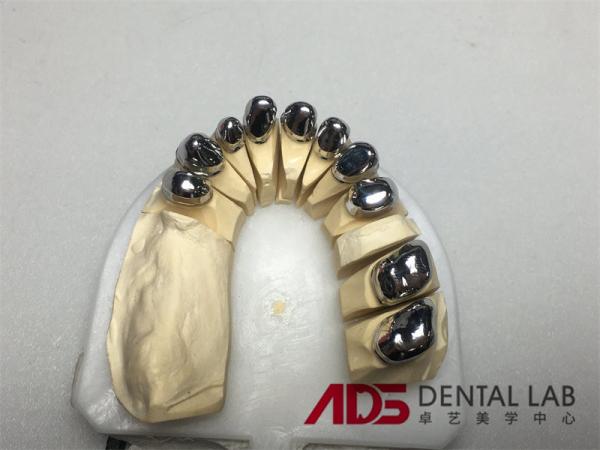 China Dental Lab Dental Implant Attachments Adjustable Telescopic