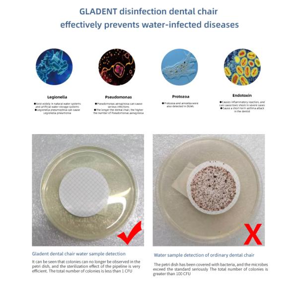 Electricity Dental Chair Stomatology Equipment With Water Purification System