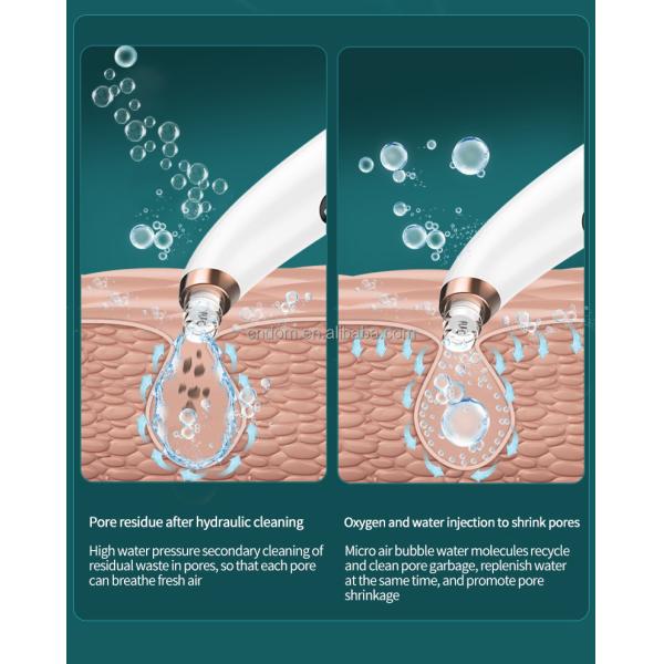 Powerful Blackhead Eliminator Vacuum Blackhead Remover Water Tank Separation Hot Item