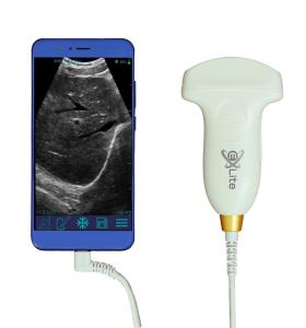 Convex Probe Handheld Veterinary Ultrasound Machine B/PWD