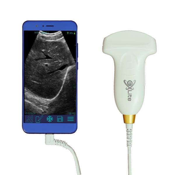 Convex Probe Handheld Veterinary Ultrasound Machine B/PWD