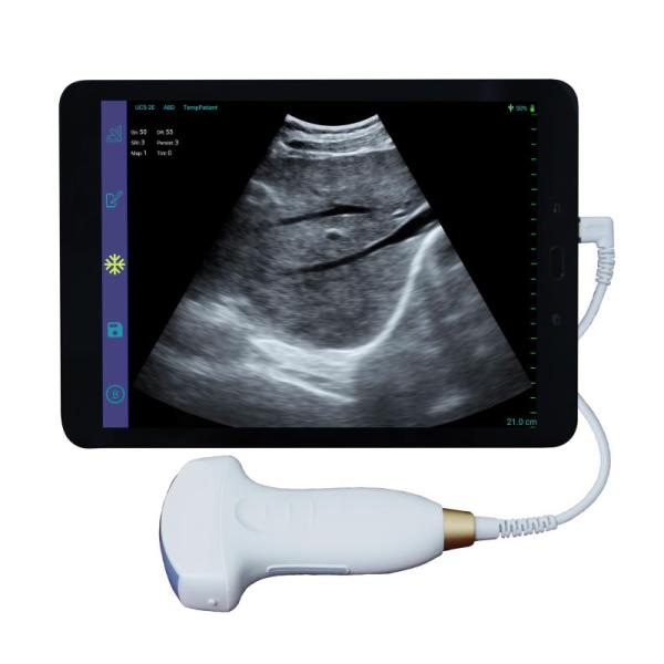 GYN ultrasound probe convex wifi usb wireless ultrasound probes for android