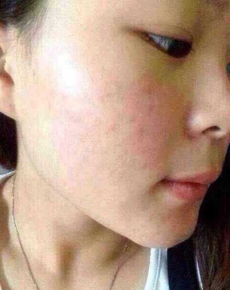 Wholesale Facial Mask