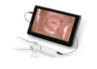 Mini Colposcope para a câmera Vaginal cervical de Examintion conectada à tevê ou ao PC